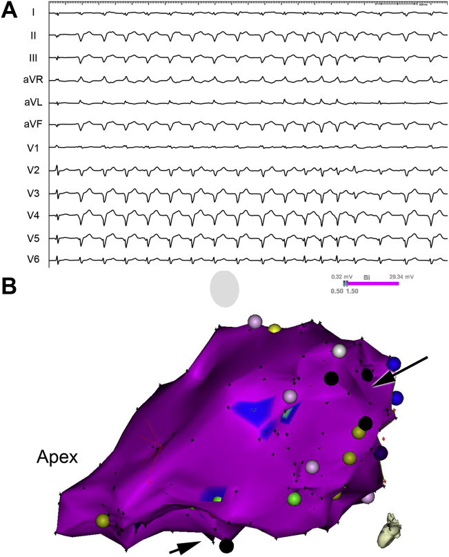 Figure 2