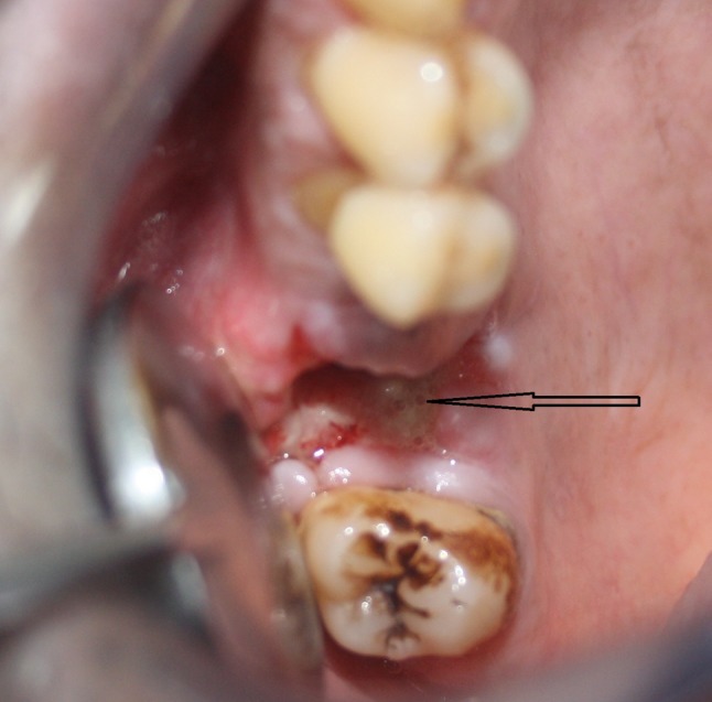 Fig. 1