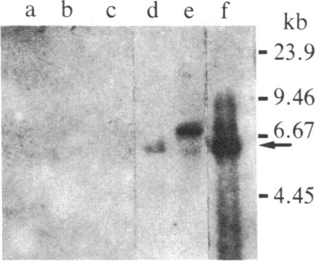 graphic file with name pnas00322-0381-a.jpg