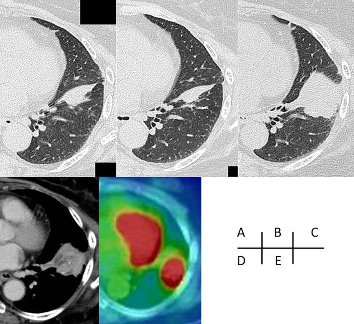 FIGURE 1