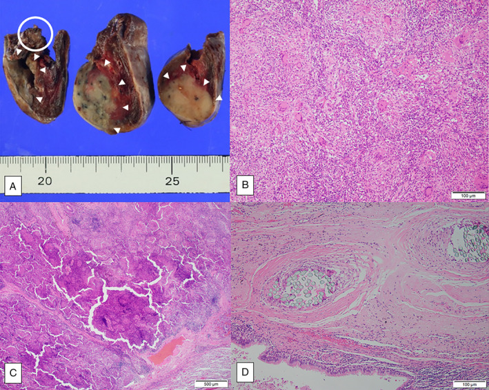 FIGURE 2