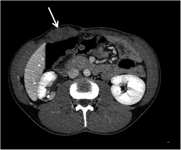 Fig. 14