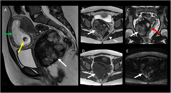 Fig. 13