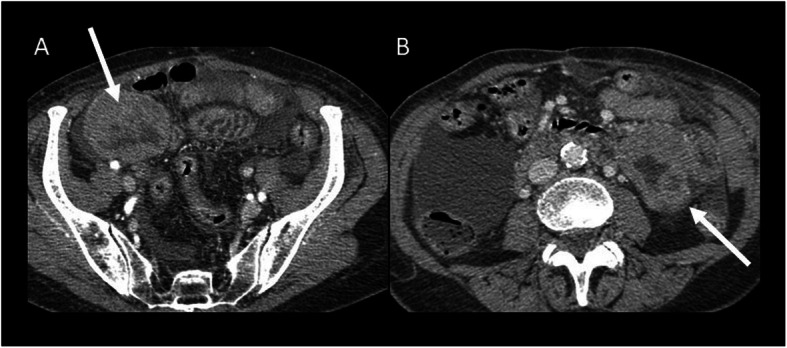 Fig. 11