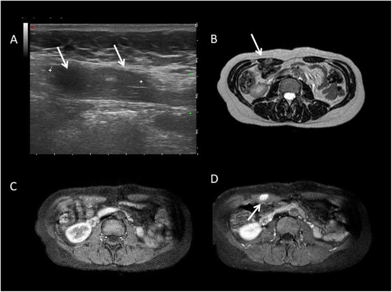 Fig. 15