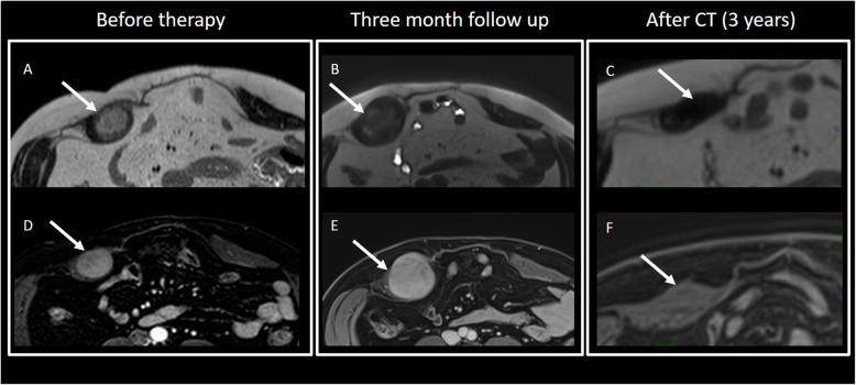 Fig. 17