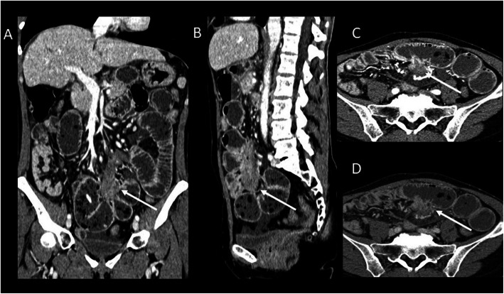 Fig. 7