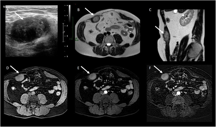 Fig. 16