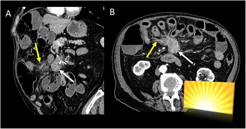 Fig. 12