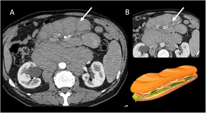 Fig. 10