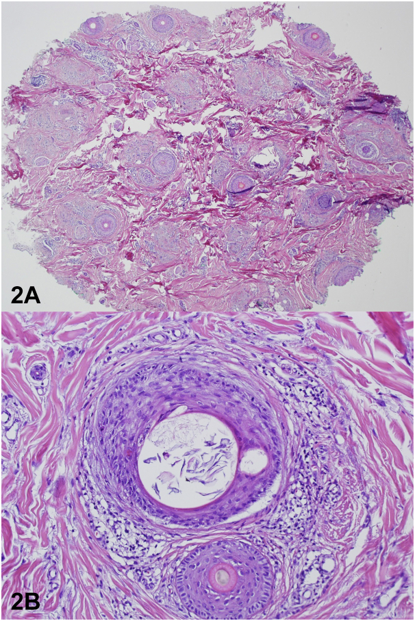 Fig 2