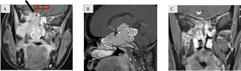 Fig. 14