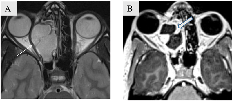 Fig. 9