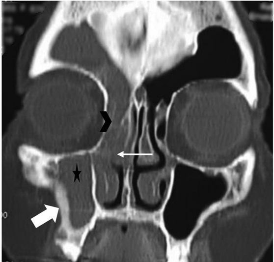 Fig. 12