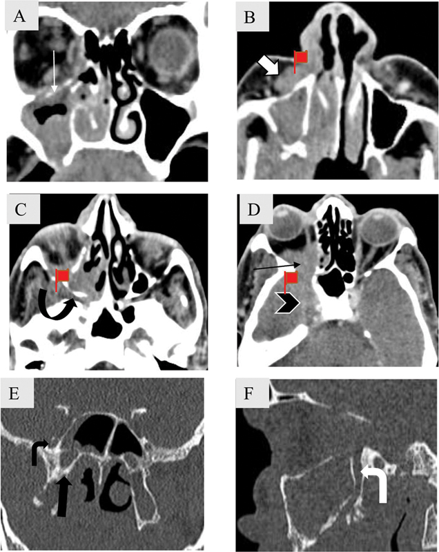 Fig. 17