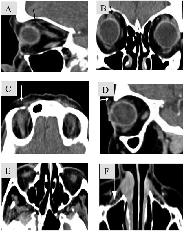 Fig. 15