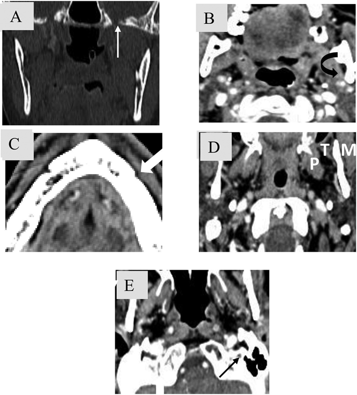 Fig. 16