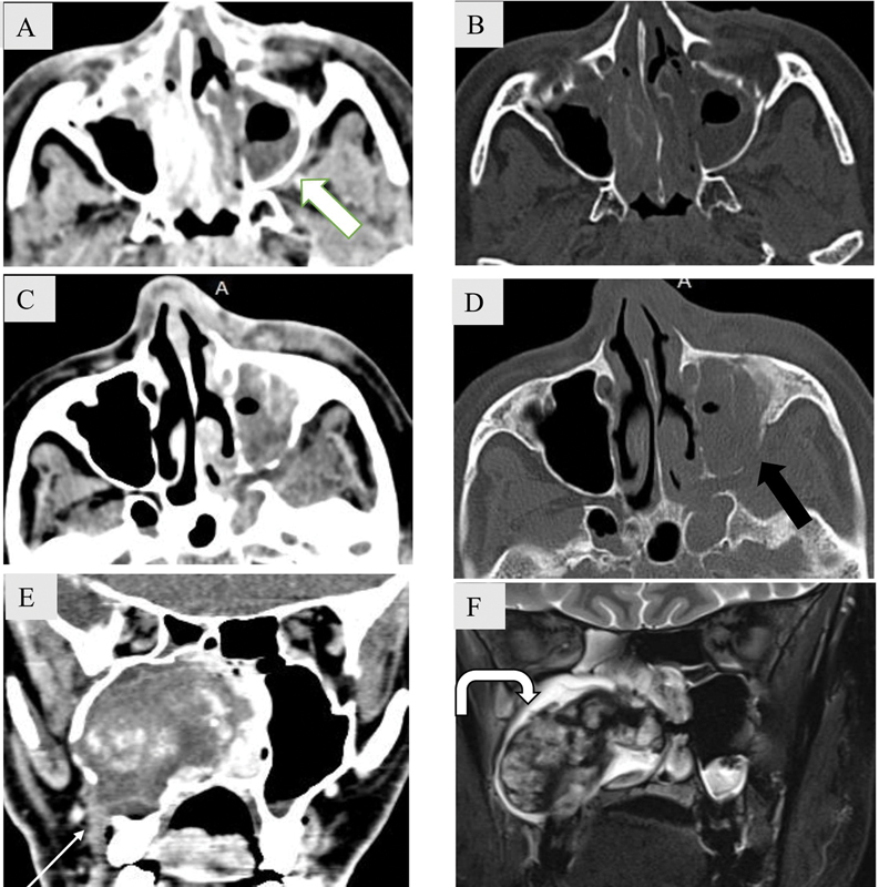 Fig. 18