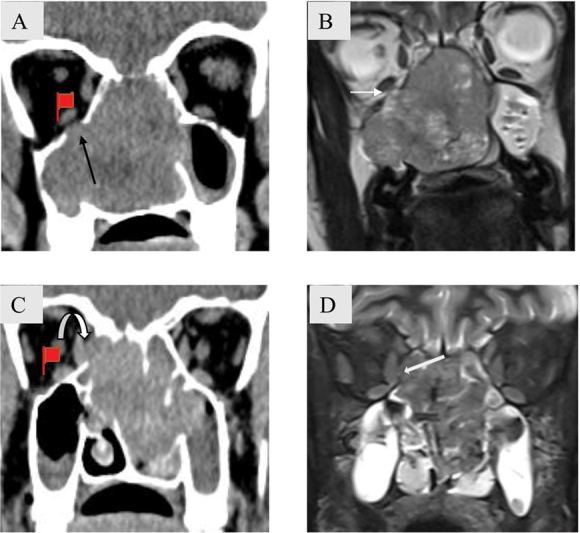 Fig. 13