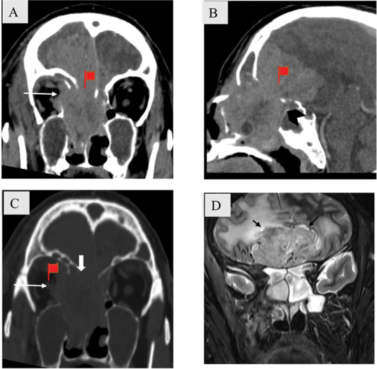 Fig. 4