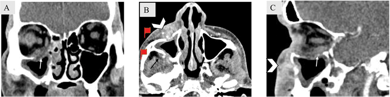 Fig. 11