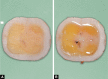 Figs 2A and B