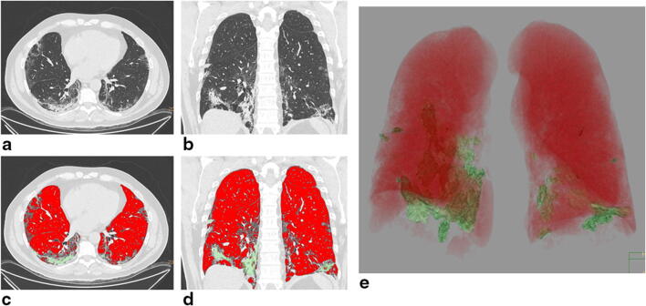 Fig. 5