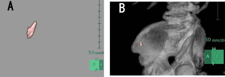 Fig 2 –