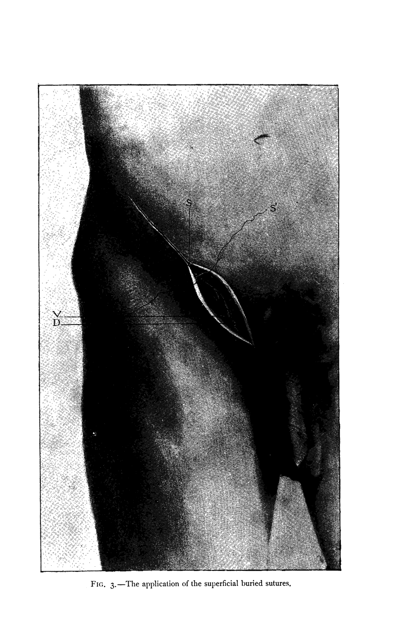 544-2