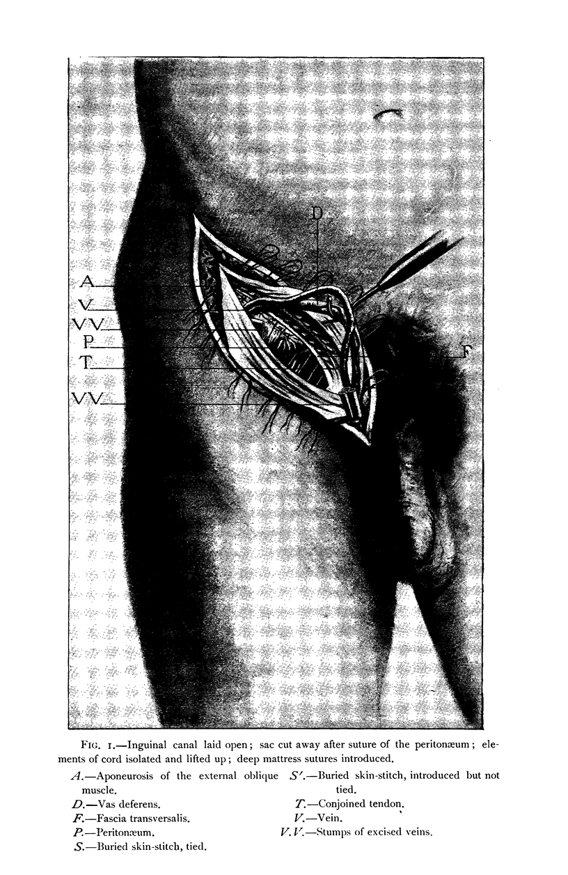 546-1
