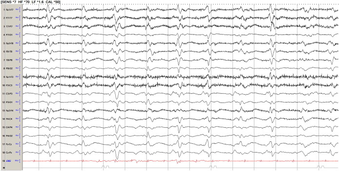 Fig. 2