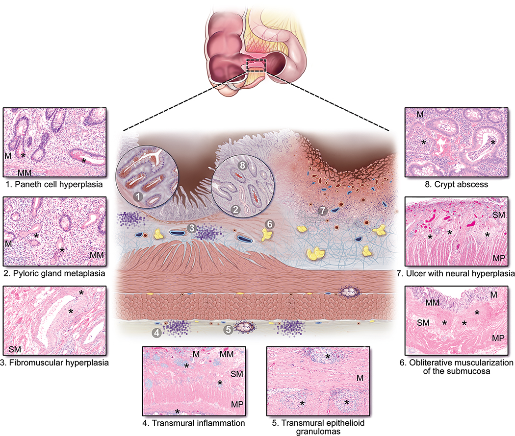 Figure 1: