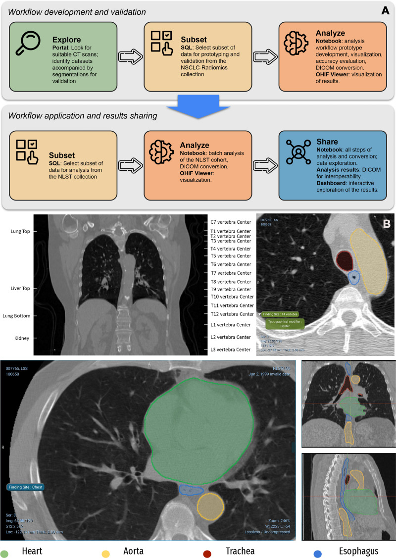 AI-generated annotations of CT images using BodyPartRegression (43) and the nnU-Net Task055 SegTHOR segmentation model (42), with further details on the application of these algorithms to the NSCLC-Radiomics and NLST collections of IDC discussed by Krishnaswamy et al (23). (A) Top panel of the flowchart shows the process of development and interaction with the individual components of IDC. The bottom panel of the flowchart shows products generated in the process of analysis. (B) Top CT images containing anatomic landmarks corresponding to the centers of vertebra and several other structures (top left) are identified and labeled automatically (top right). Bottom CT images show volumetric segmentations of the pixels corresponding to the heart, esophagus, aorta, and trachea.