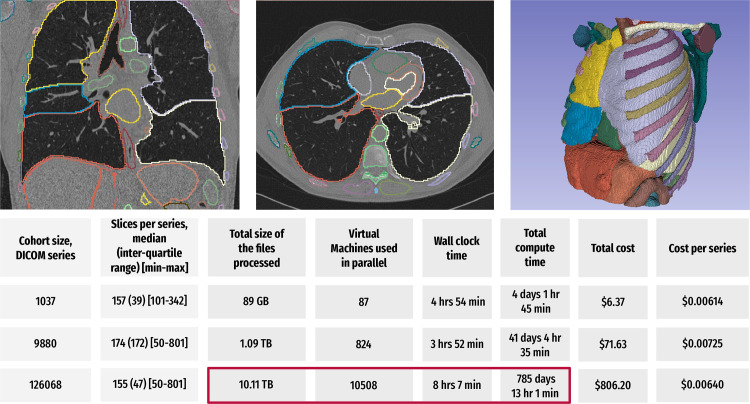 Summary of the results of a preliminary study evaluating the time- and cost-efficient scalable application of the TotalSegmentator algorithm (58) to the IDC NLST collection using CRDC resources. For each of the analyzed cases in the three cohorts of sizes 1037, 9880, and 126 068 in a CT series, the algorithm was used to segment up to 104 anatomic structures (depending on the coverage of the anatomy in a given imaging examination), followed by the extraction of the shape and first-order radiomics features for each of the segmented regions using the pyradiomics library (59). Coronal and axial CT images (top left and center, respectively) and a surface rendering of the segmentations generated using 3D Slicer (https://slicer.org) software (top left) show sample visualizations of the analysis (60). Bottom table summarizes the key parameters and observed performance of the two experiments. The total compute time corresponds to the time needed to perform computation sequentially. In the case of the 126 068 series analysis (red box), scaling of the processing to use 10 508 cloud-based virtual machines in parallel reduced the processing time from the estimated more than 785 days by using a single virtual machine to about 8 hours. The costs are expected to be even lower for the researchers eligible to access the discounts provided by the National Institutes of Health Science and Technology Research Infrastructure for Discovery, Experimentation, and Sustainability (STRIDES) Initiative.