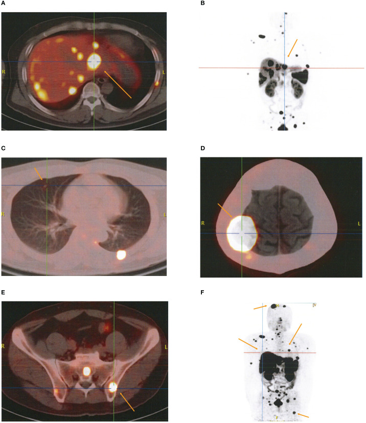 Figure 3