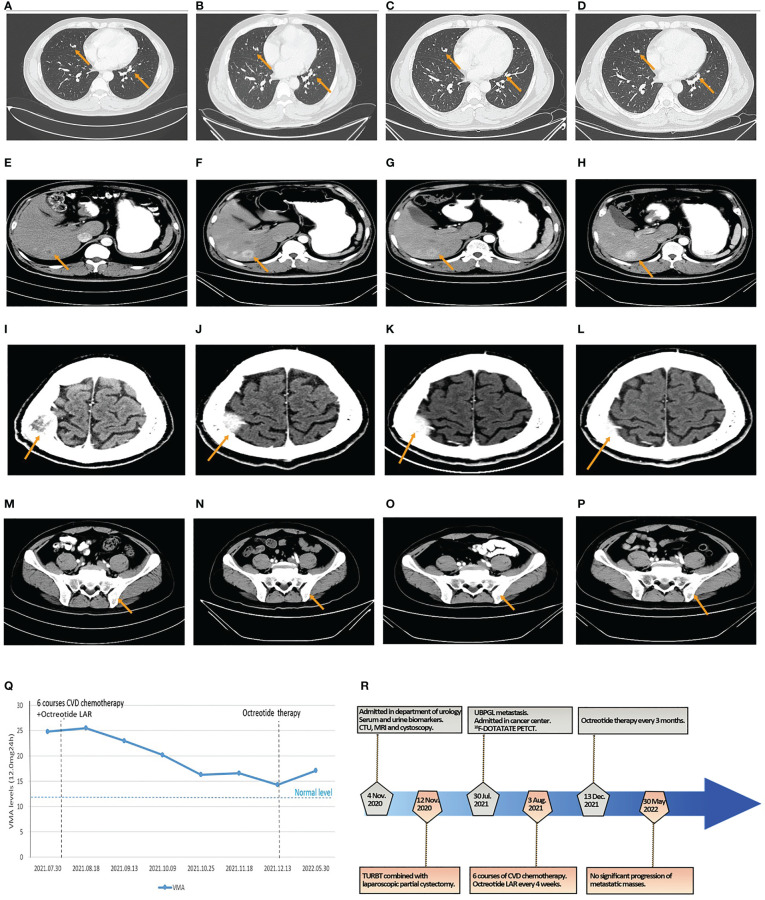 Figure 4