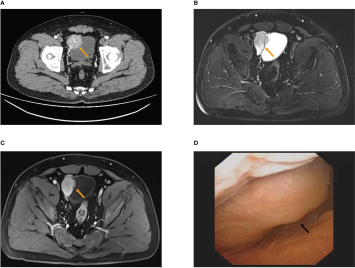 Figure 1