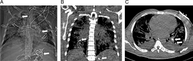 Figure 1