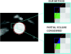 Explanation of partial volume calculation. The red contour identifies the vessel boundary at this time point. In our method, the green highlighted pixel has more than 50% of its area inside the contour and thus would be included in the flow calculation while the blue pixel would not. In the lower right image, we highlight the partial area of the pixel included in the sector to be used for flow quantification.