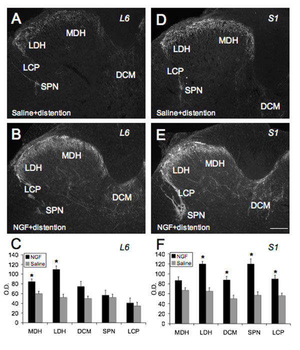 Exogenous Overexpression Of Nerve Growth Factor In The Urinary Bladder Produces Bladder