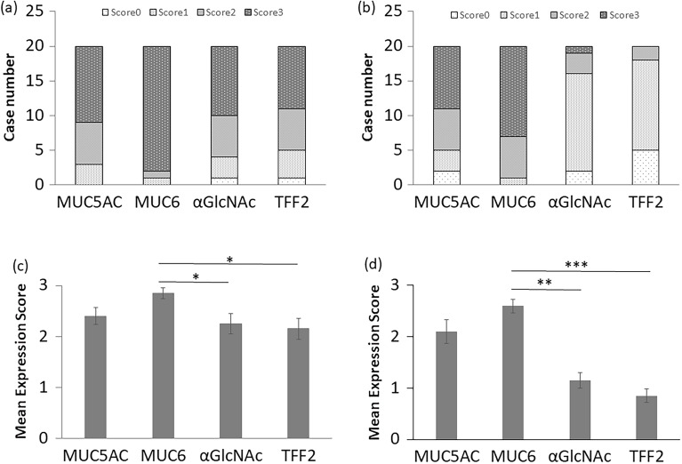 Decreased Expression Of Tff2 And Decreased αglcnac Glycosylation Are 