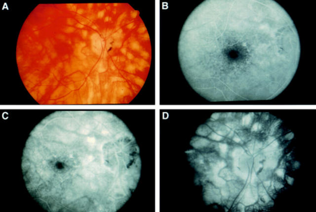 Figure 2  