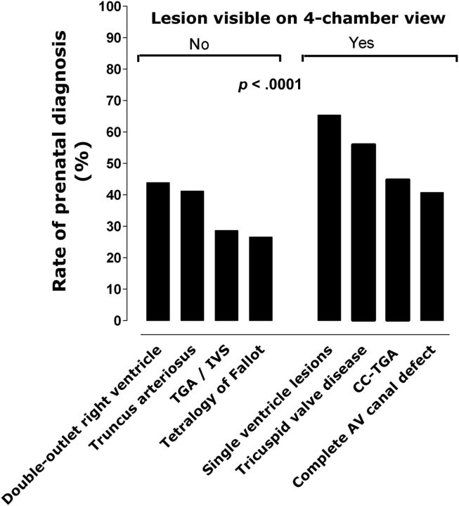 FIGURE 2. PDRs are demonstrated by defect visibility on 4CV (No/Yes). AV, atrioventricular; CC-TGA, congenitally corrected transposition of the great arteries; TGA/IVS, transposition of the great arteries with intact ventricular septum. Single-ventricle lesions include HLHS.