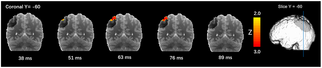 Fig. 3.