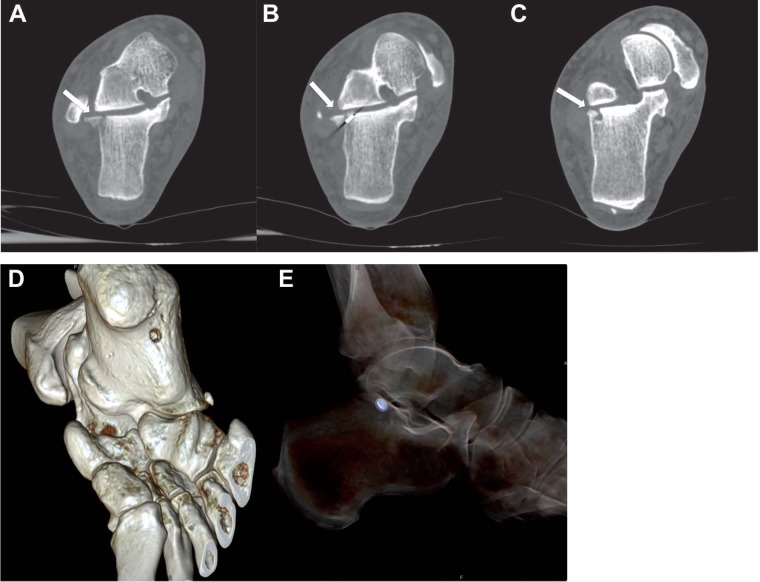 Figure 4.