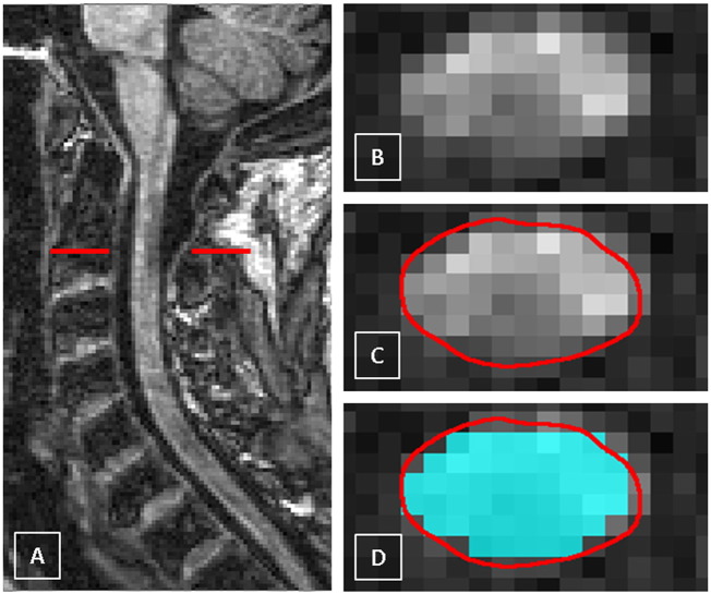 Fig. 2