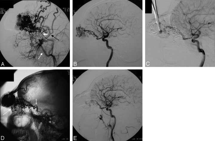 Fig 1.