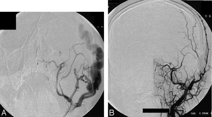 Fig 3.