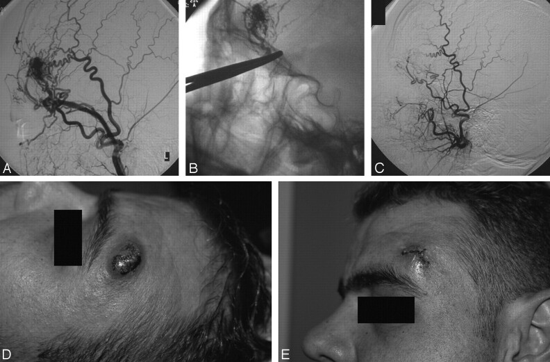 Fig 4.