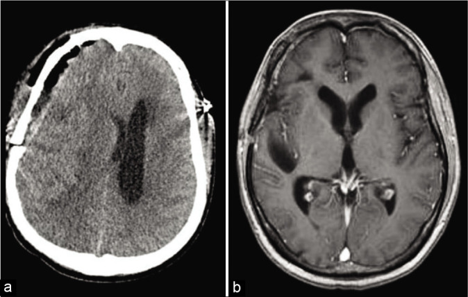 Figure 3: